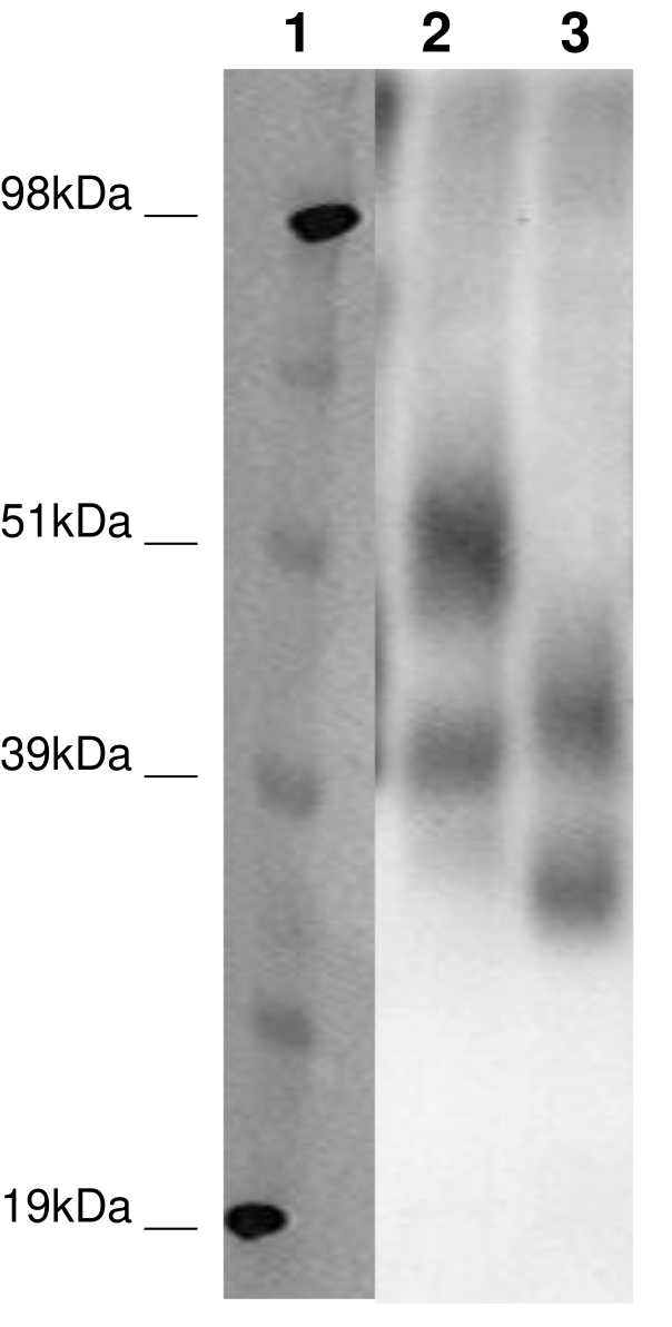 PathHunter® Human GPR32 β-Arrestin Stable Cell Line Assay (CHO-K1)