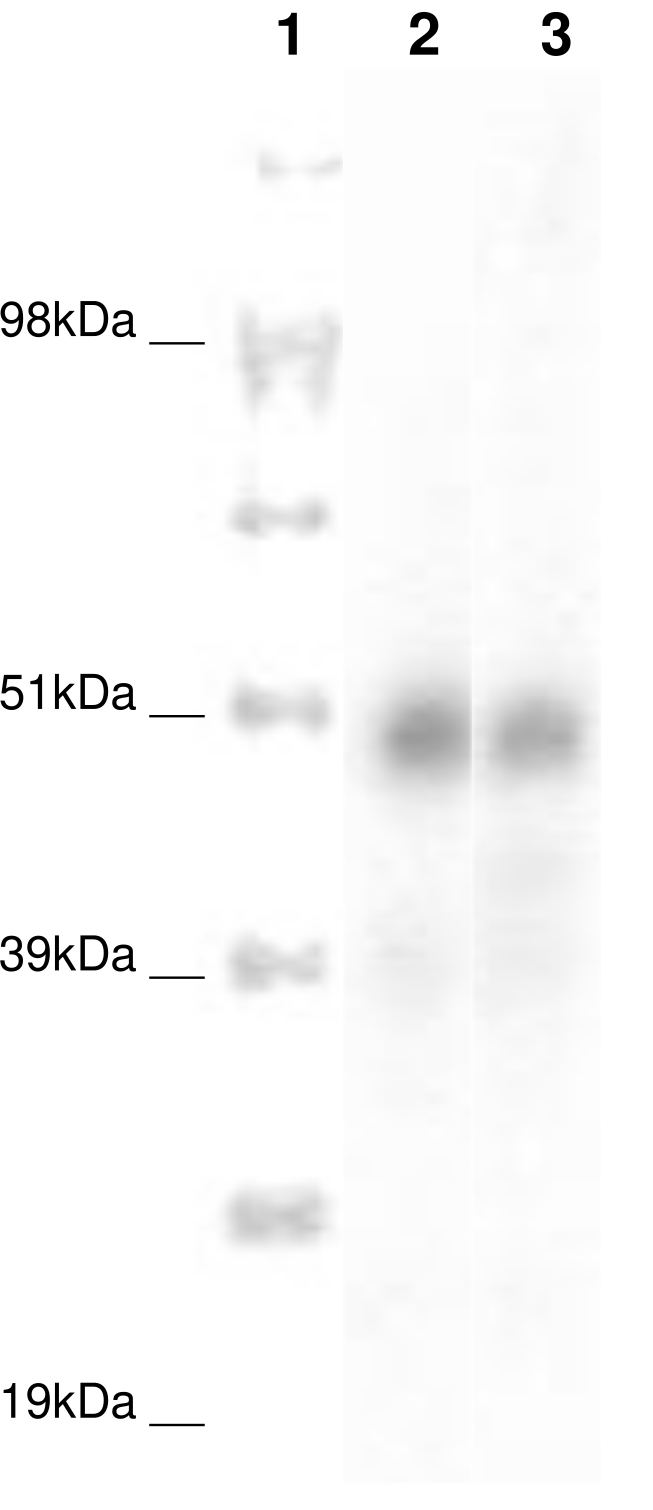 PathHunter® Human CCRL2 β-Arrestin Cell-Based Assay Kit (CHO-K1)