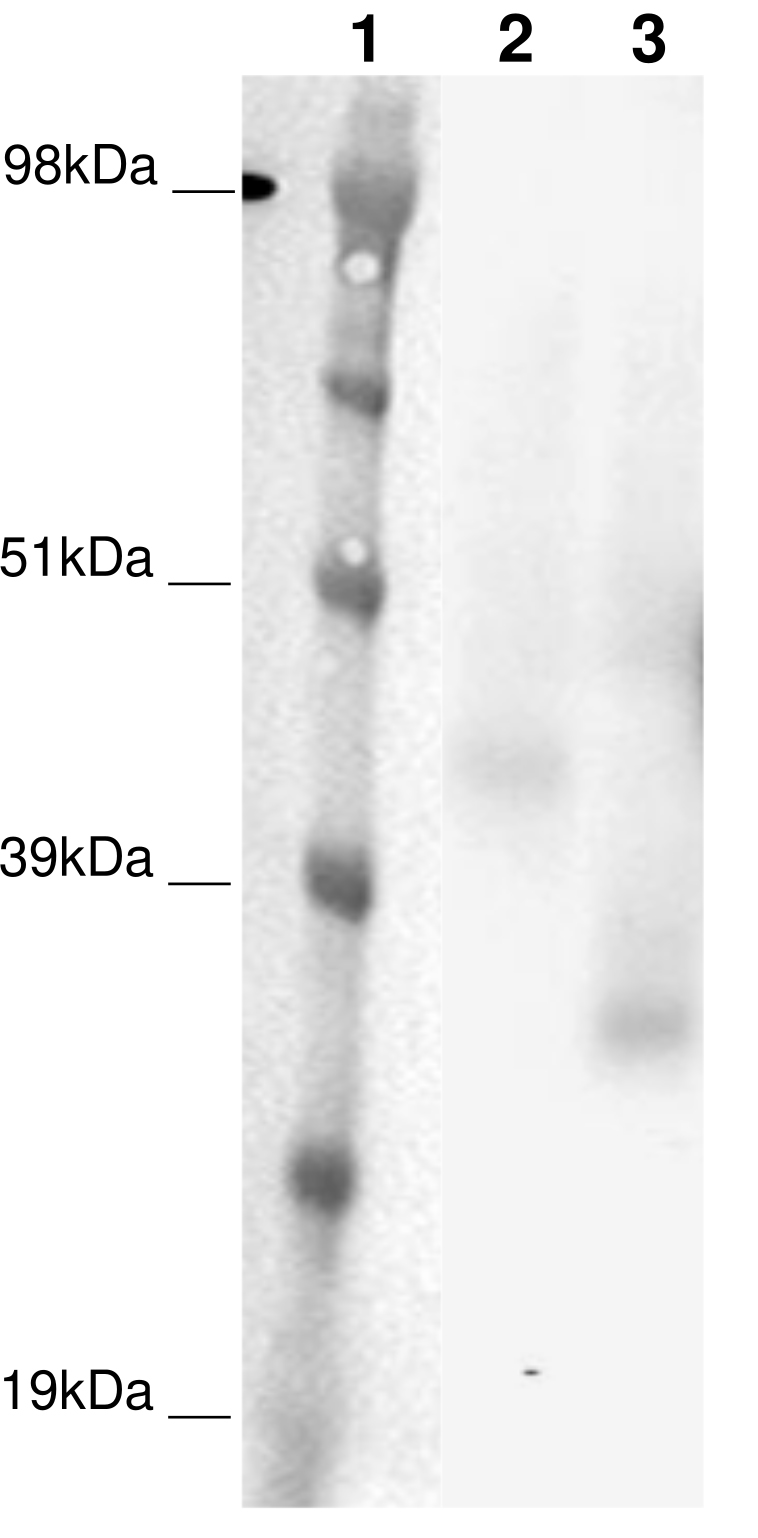 PathHunter® Human Ghrelin (GHSR1b) β-Arrestin Cell-Based Assay Kit (CHO-K1)
