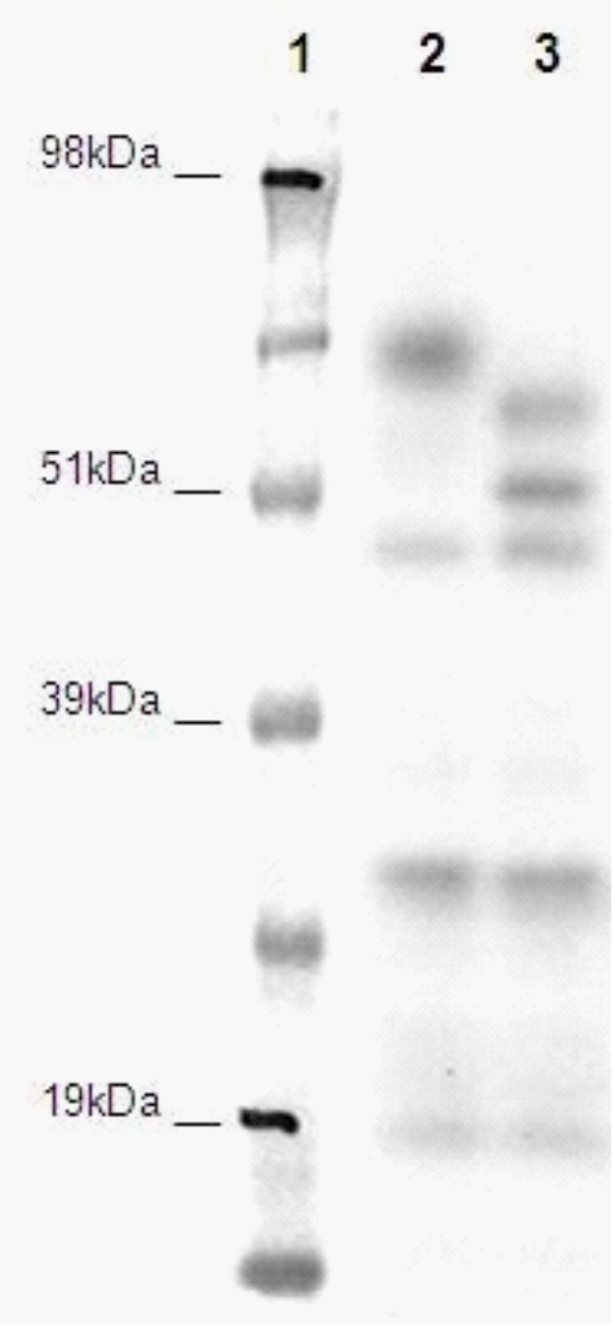 PathHunter® Human GPR150 β-Arrestin Cell-Based Assay Kit (HEK 293)
