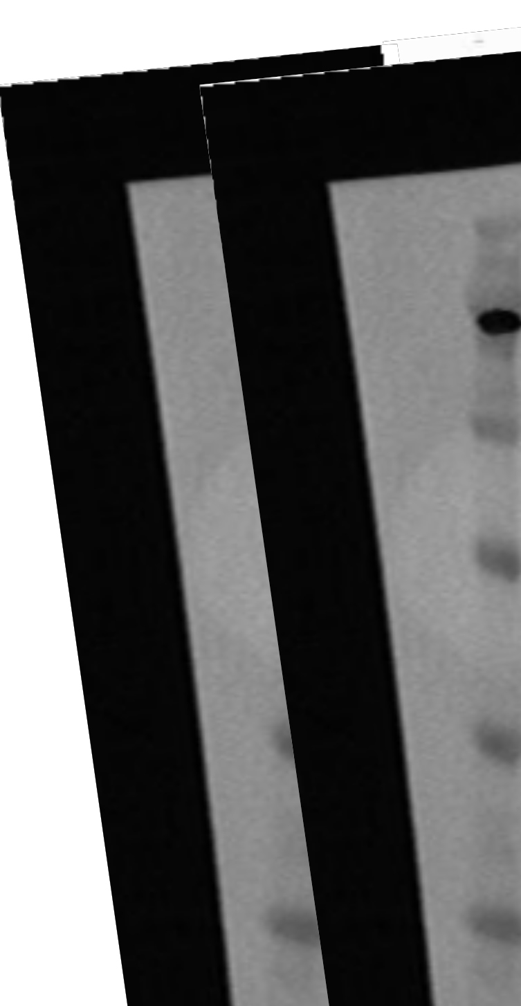PathHunter® Human GPR20 β-Arrestin Stable Cell Line Assay (HEK 293)
