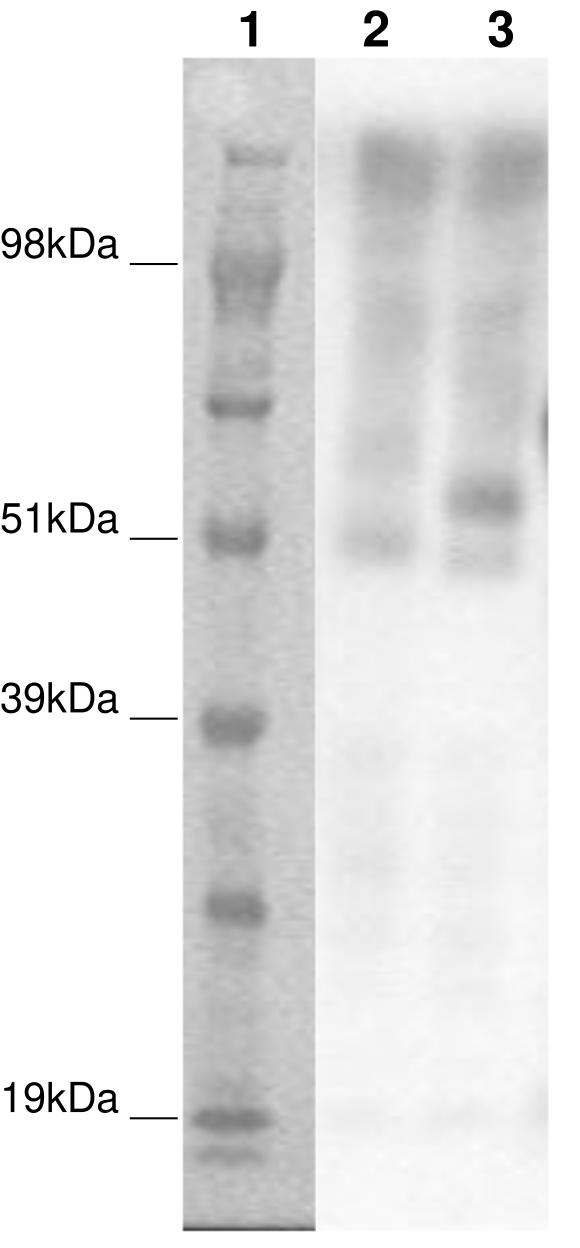 PathHunter® Human GPR61 β-Arrestin Stable Cell Line Assay (CHO-K1)