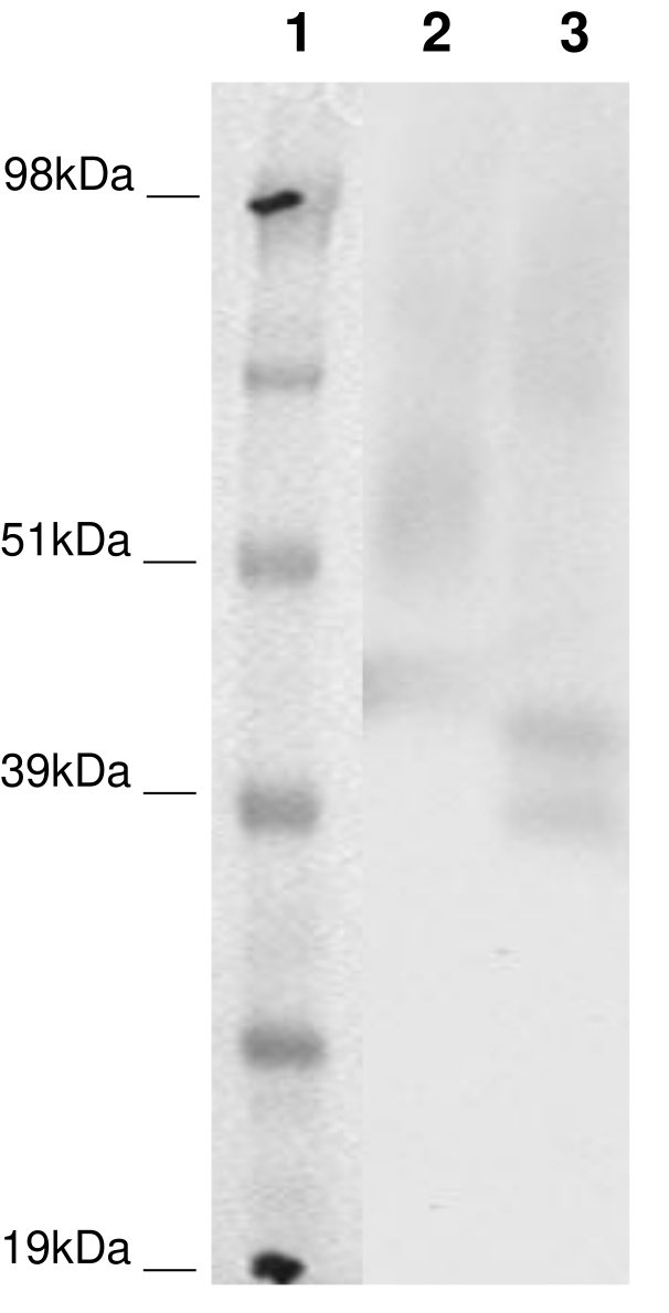 PathHunter® Human P2RY8 β-Arrestin Stable Cell Line Assay (CHO-K1)