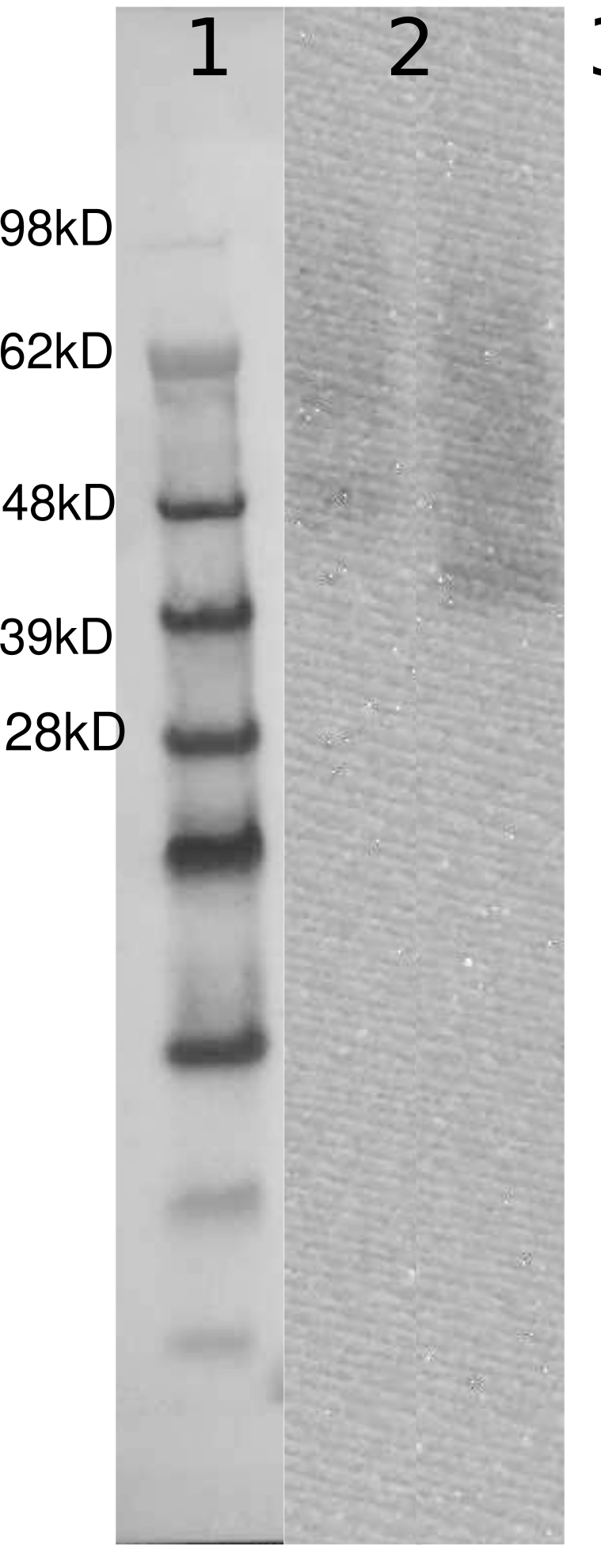 PathHunter® Human GPR22 β-Arrestin Cell-Based Assay Kit (U2OS)