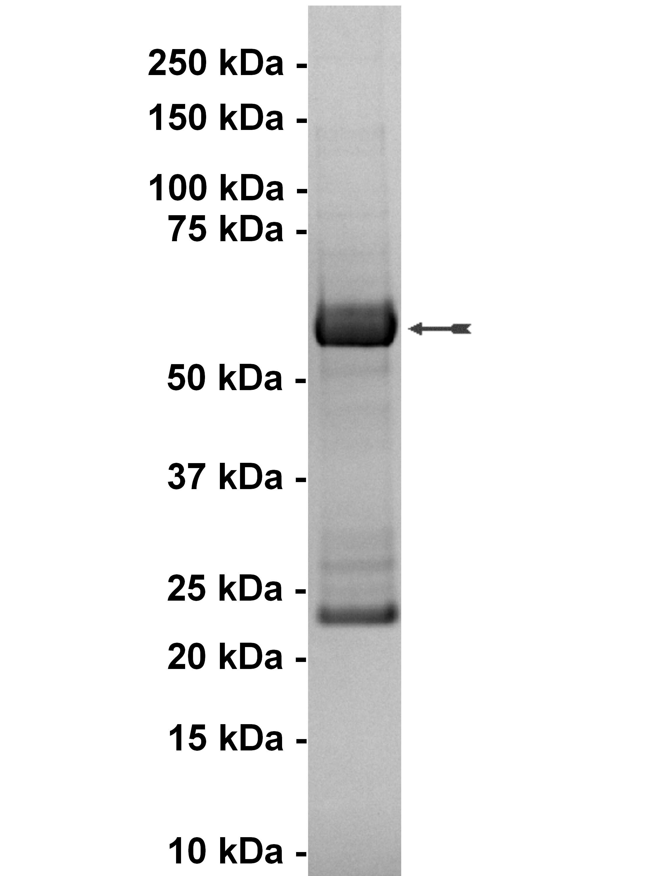 JAK1, active