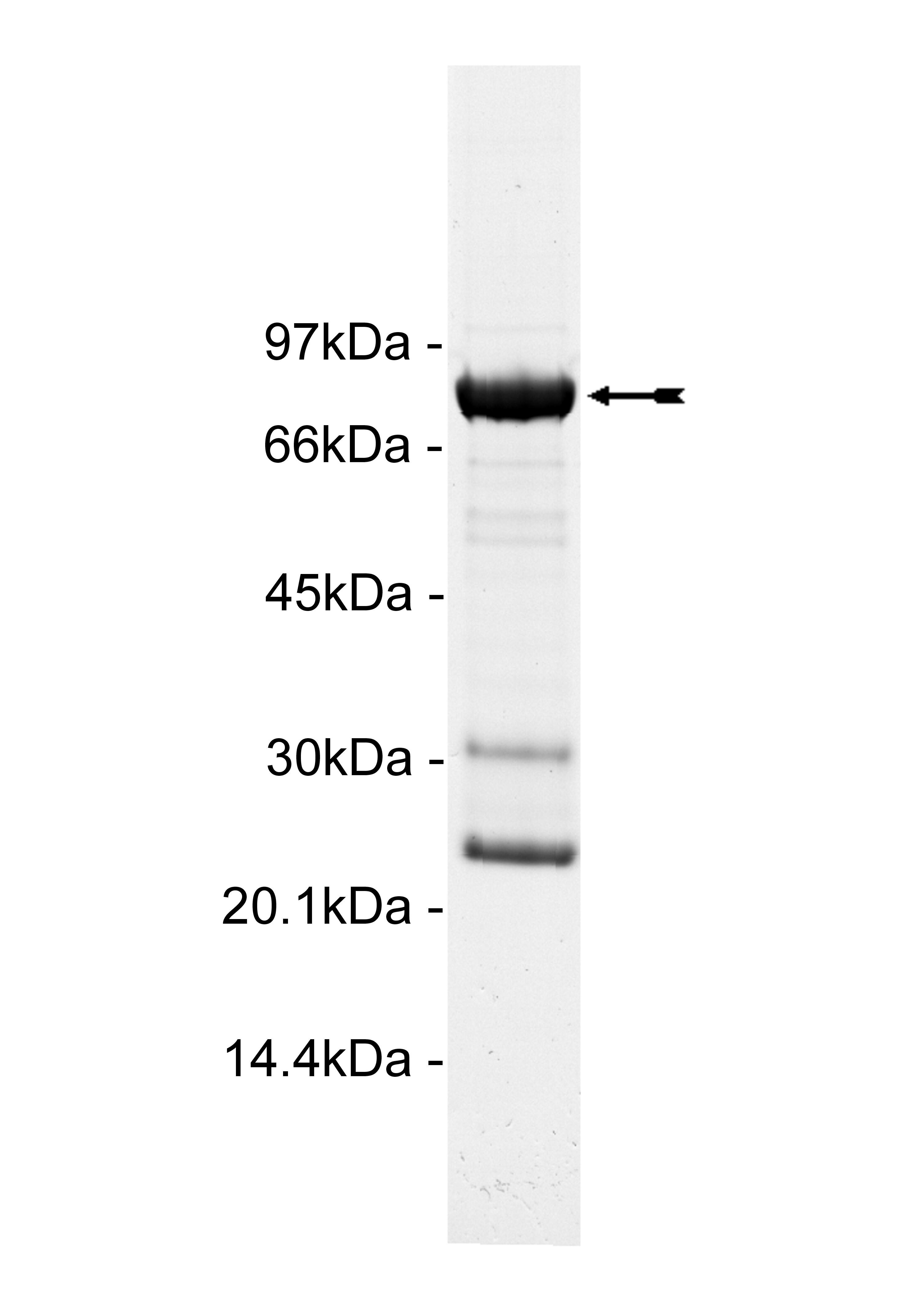 Ret (V804L), active
